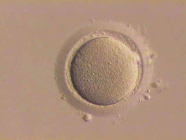 Яйцеклетки можно будет хранить дома в виде порошка